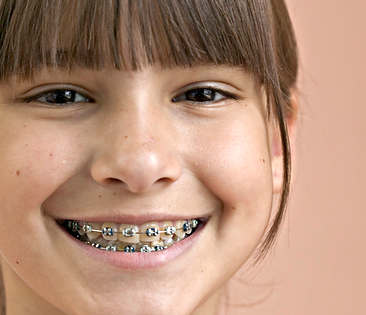 Krankenzusatzversicherung - lächelndes Mädchen mit Zahnspänge